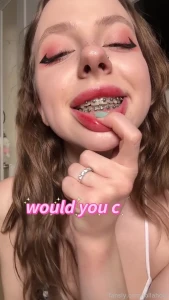 Lollaholy college altgirl cute closeup braces mouth cuteface