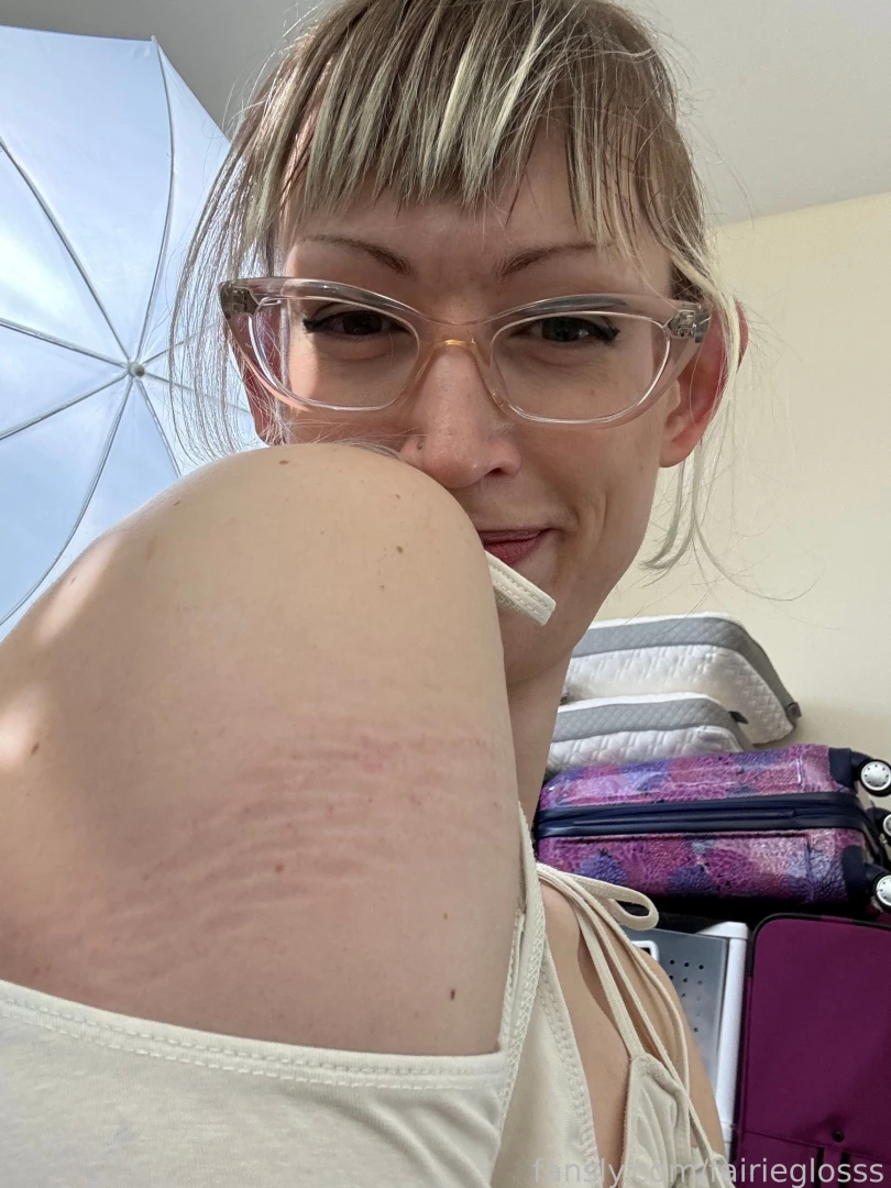 I love rope marks so much they feel like a lil accomplishment a little 