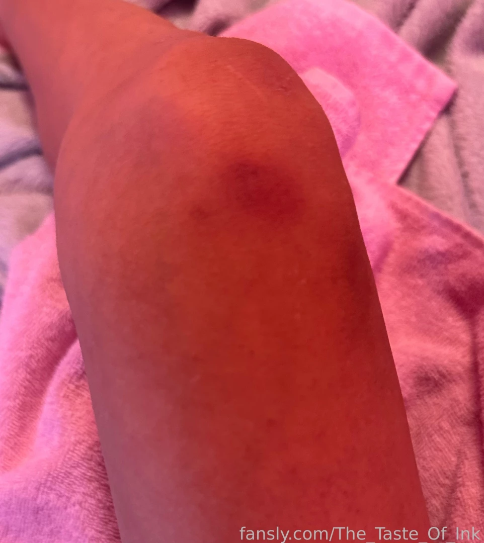 Went to another show and got bruised xd my butt didnt get any but im part 6 