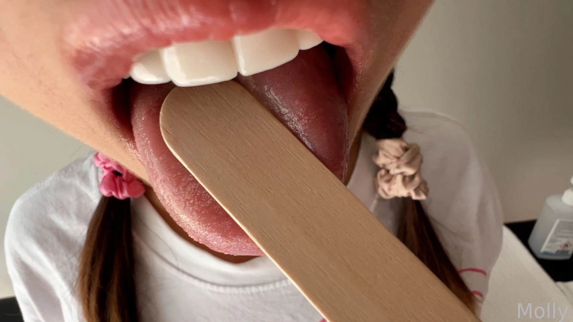 Doctor visit went awkward xd full video in next post teen fyp young 18 