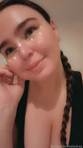 Been tucked away working for the last week accutane is still doing its part 1