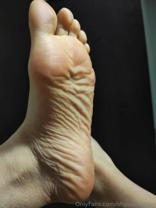 Wrinkled and fleshy part 1
