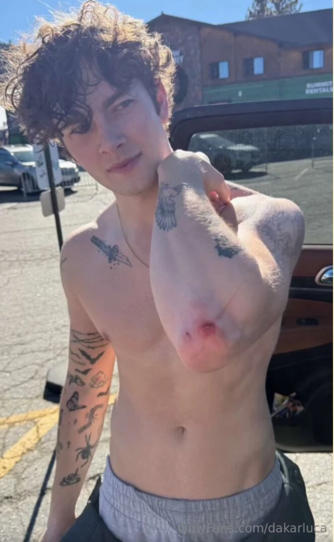 Got a boo boo nbsp whos gonna come kiss it 