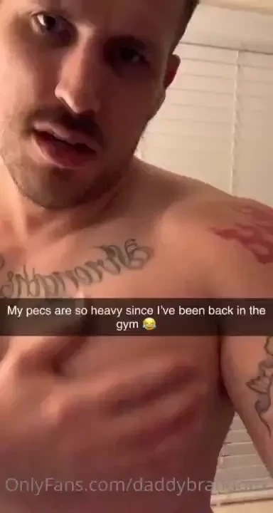 Broke my leg earlier this year but i m all fixed and i m back in the 