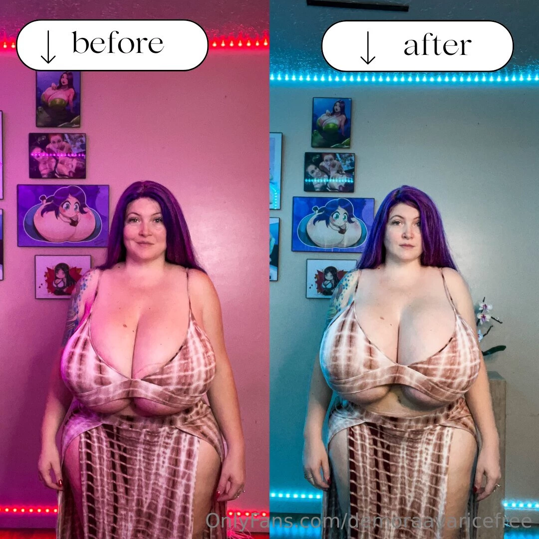 Finally getting a before after set red lighting is before surgery blue 
