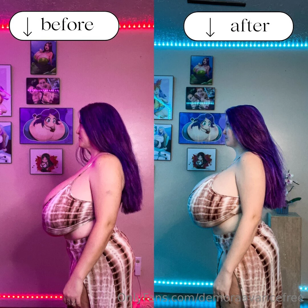 Finally getting a before after set red lighting is before surgery blue part 2 