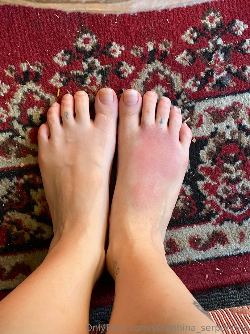 I started training again in mma amp i may have gone a bit too hard 