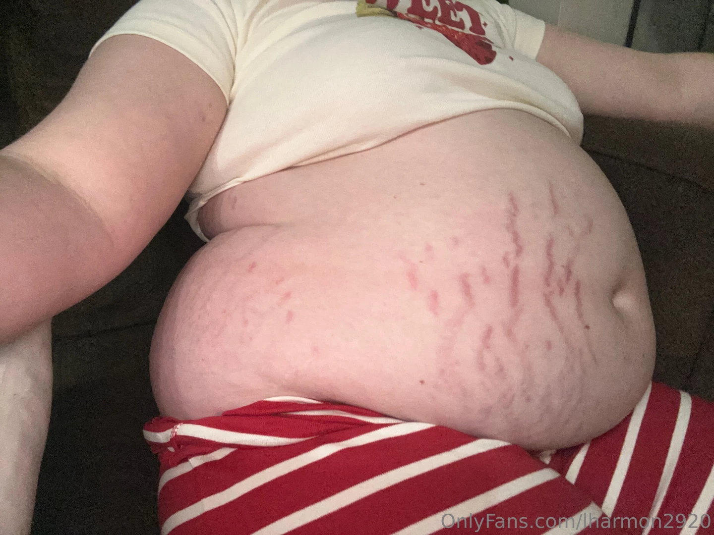 I guess i ate too many sweets 