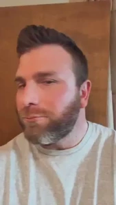 Beard is coming back