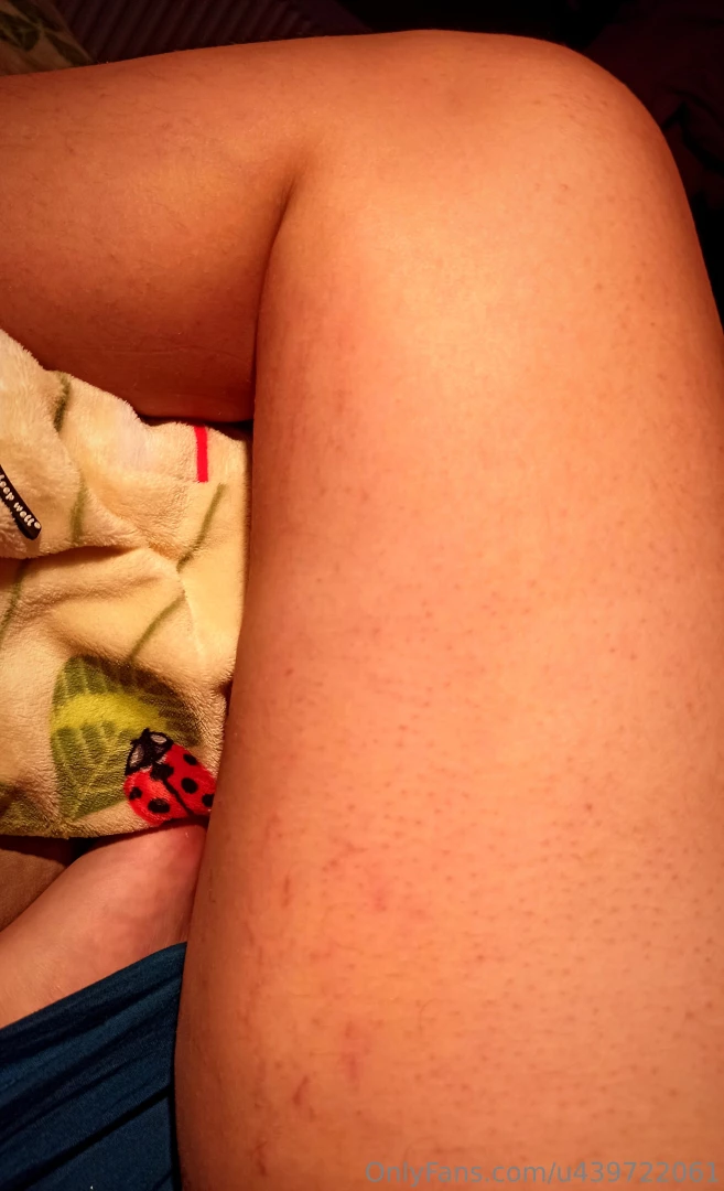 Stretch-marks on my thighs old ones vs new ones curious how it gonna 