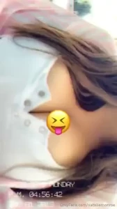 Nip slip part 83