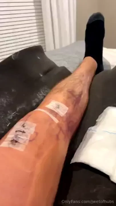 Just so u guys know why i spaced the content a little bit lol acl 