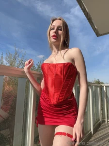 You know what that is on my leg