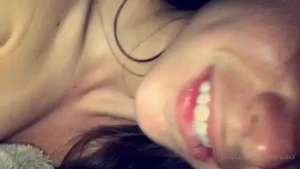 I got really sun burned part 5