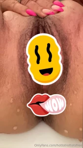 New beautiful butthole was well worth all the pain i went through a