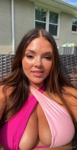 Slight burn on my face