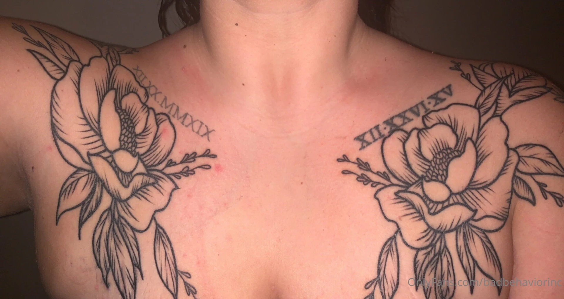 She s healing so nicely 