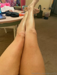 A little fur never hurt anyone part 1