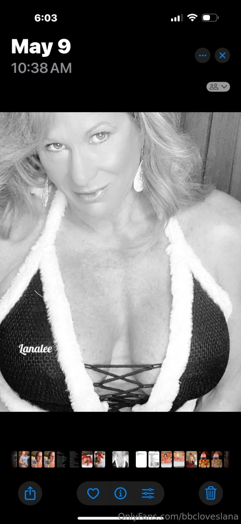 I m getting plastic surgery next week if you want to help support me 