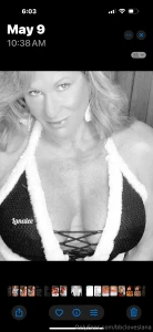 I m getting plastic surgery next week if you want to help support me