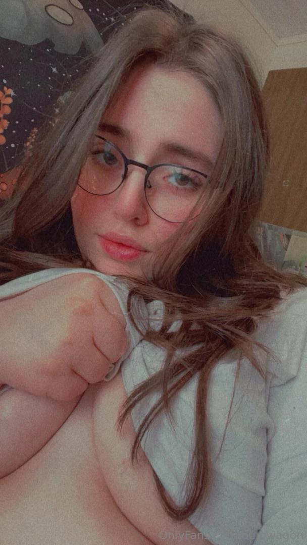 Hiiii baby look at all these bites you left all over me from the other 