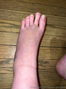 My foot currently
