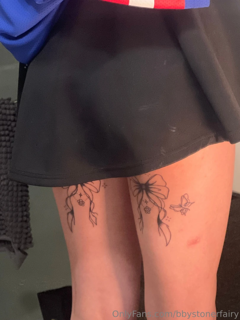 My bows b healing nicely eeee i m obsessed w them part 1 