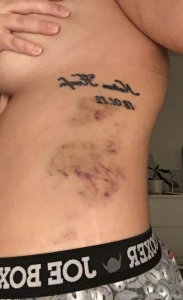 Thowback at the bruises i got during sex i love it when i get marked