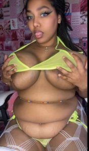 You think i have too many stretch marks