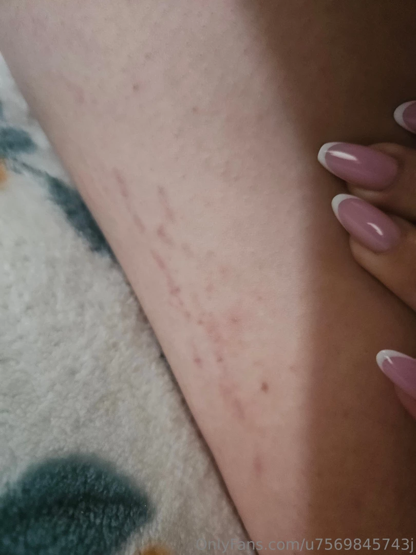 Yesterday i saw new stretch marks on myself 