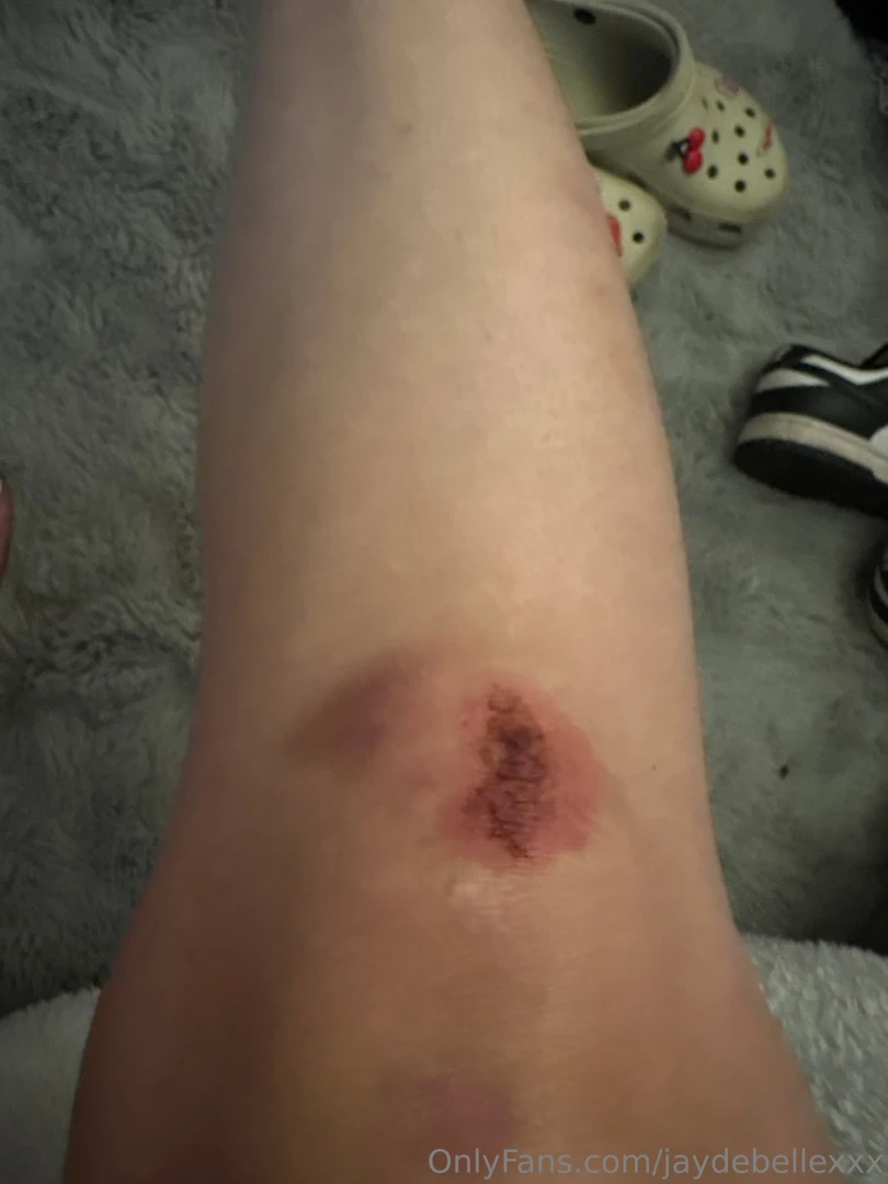 Got in a car accident last night so i m pretty out of commission for 