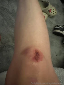 Got in a car accident last night so i m pretty out of commission for