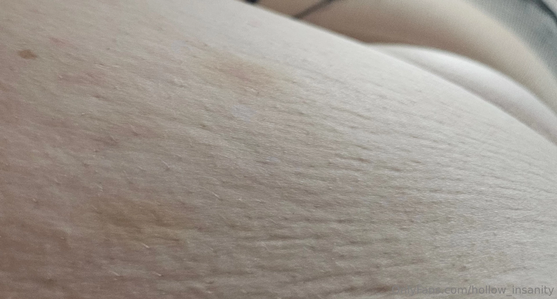 I heard you guys like stretchmarks on boobs 