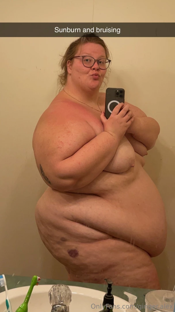 Big girl small chair bruised legs 