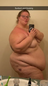 Big girl small chair bruised legs