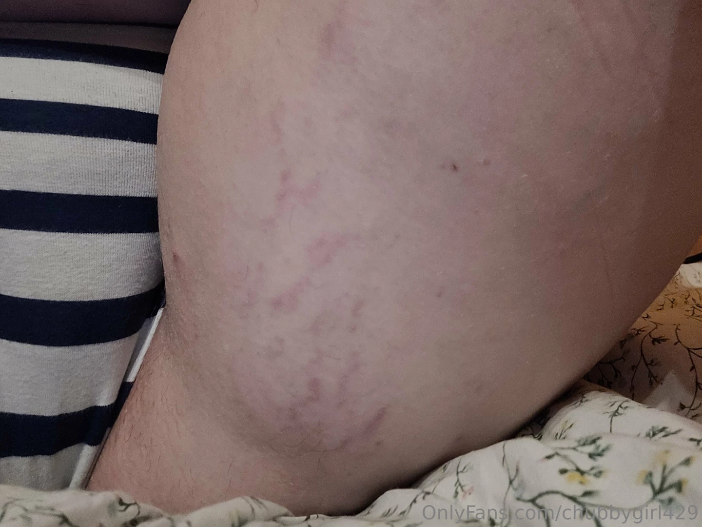 Not the most flattering angle but my inner thighs have suddenly 