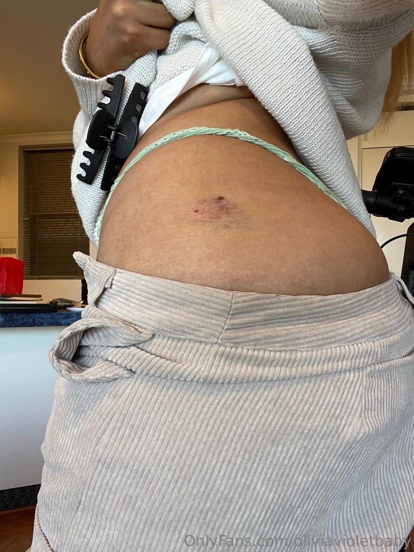 Kiss it better part 8 