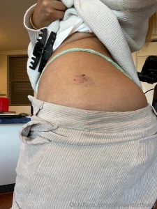 Kiss it better part 8