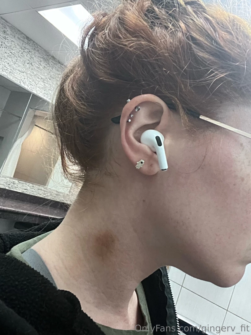 Put my hair up at the gym to discover one on each side oops 