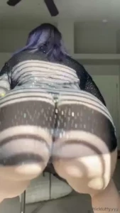 Hiiii i normally don t have a double chin my face is still swollen part 7