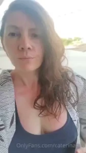 Oof you guys the sunburn on my boobies is nothing compared to my legs