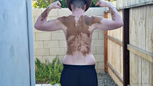 Vitiligo backshots sunday part 4