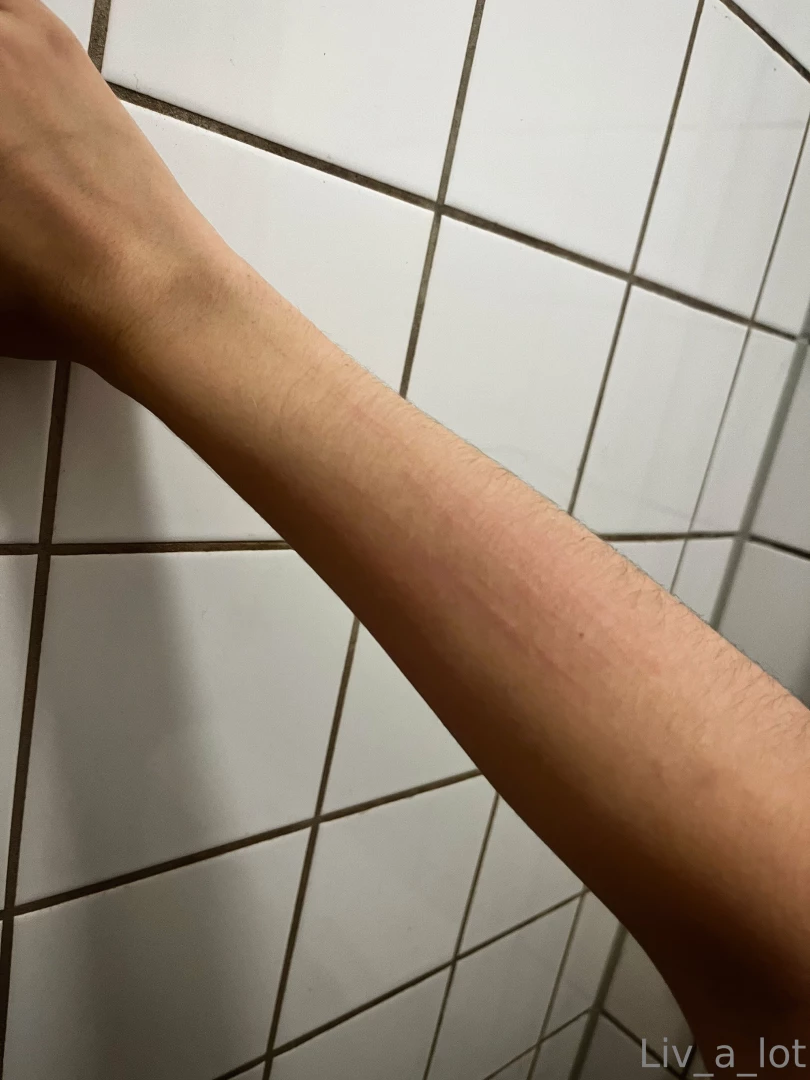 The end result of playing with darkwhiskas the marks on my boob are 