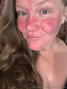 Good morning i woke up wondering what happened to my face then it hit part 1