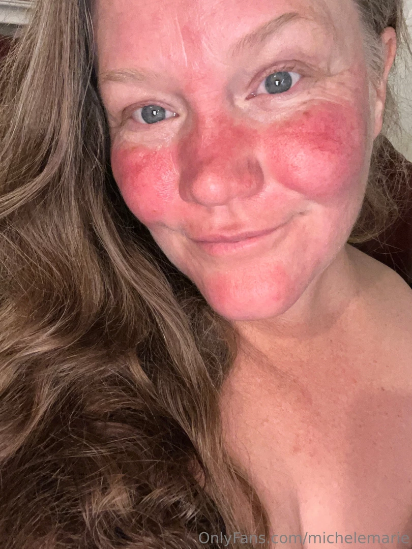 Good morning i woke up wondering what happened to my face then it hit part 2 