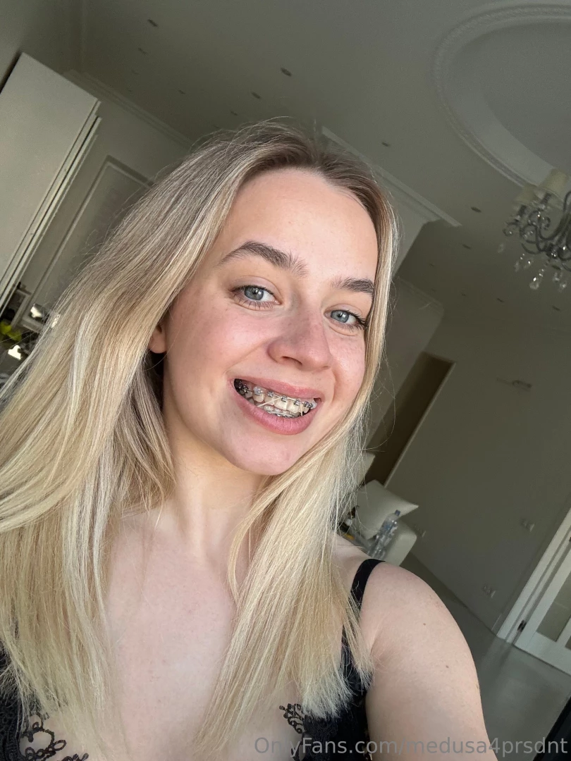 Rate my braces part 2 