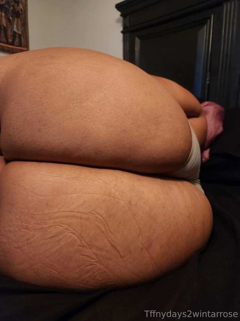 Just a case of bed butt 