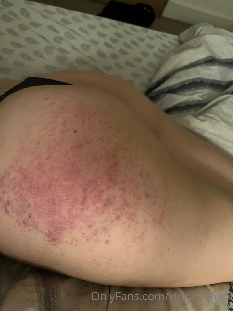 Viridityangel part 82003 