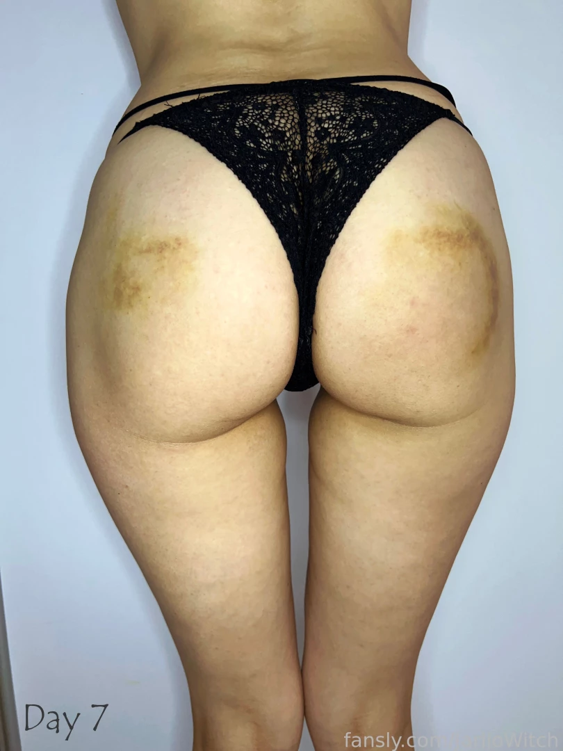 I got a serious can1ng two weeks ago since then i documented the part 3 