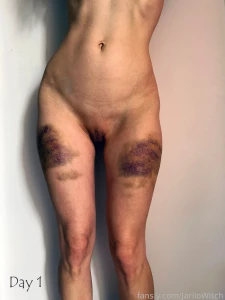 I got a serious can1ng two weeks ago since then i documented the part 4